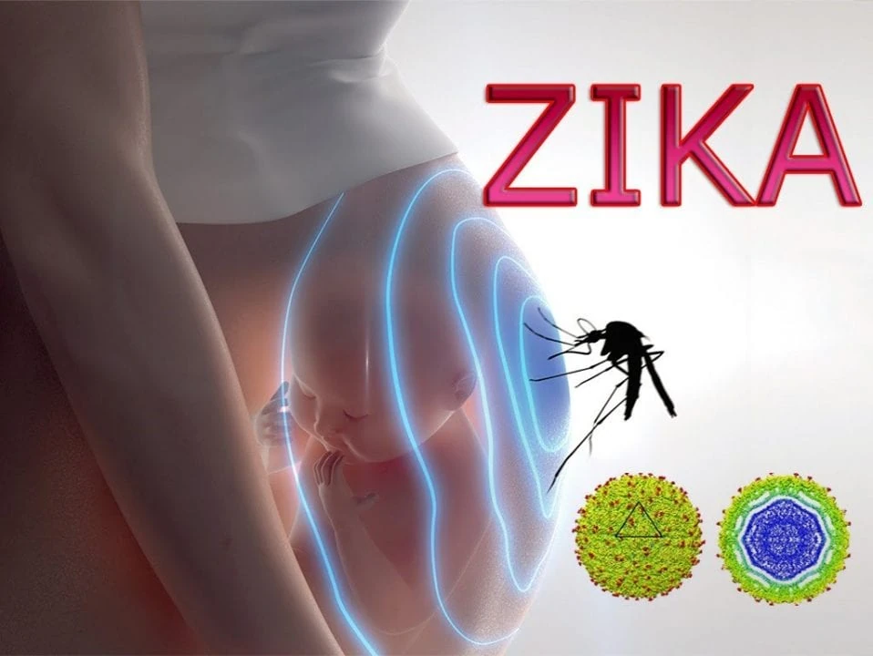 Virus Zika: Lo que Ud debe saber